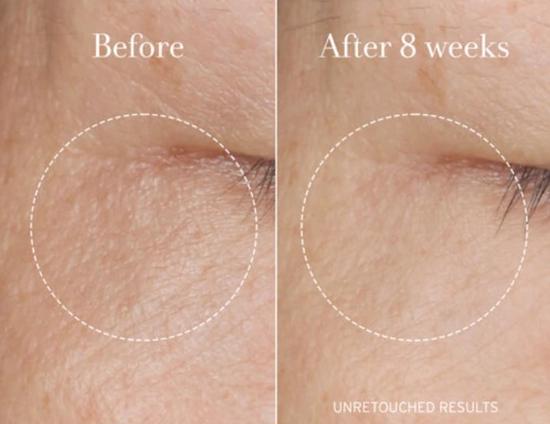 Men genel Rose Super - Antioxidant Serum