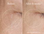Men genel Rose Super - Antioxidant Serum